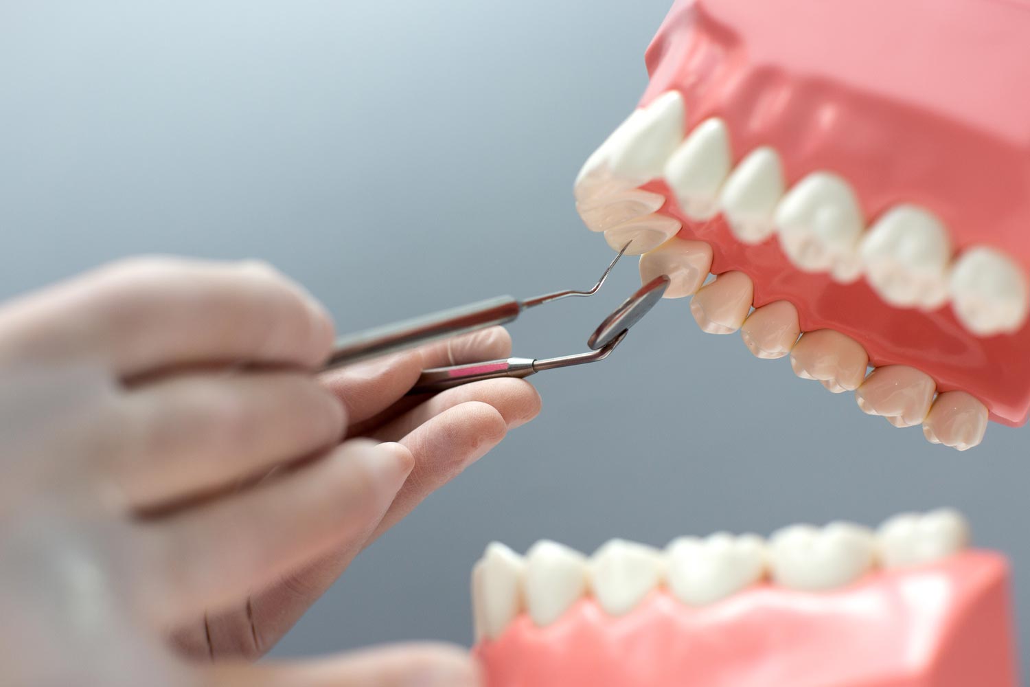 dental-restoration dental-restoration