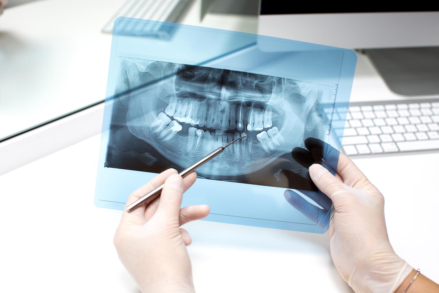 dental-x-ray dental-x-ray