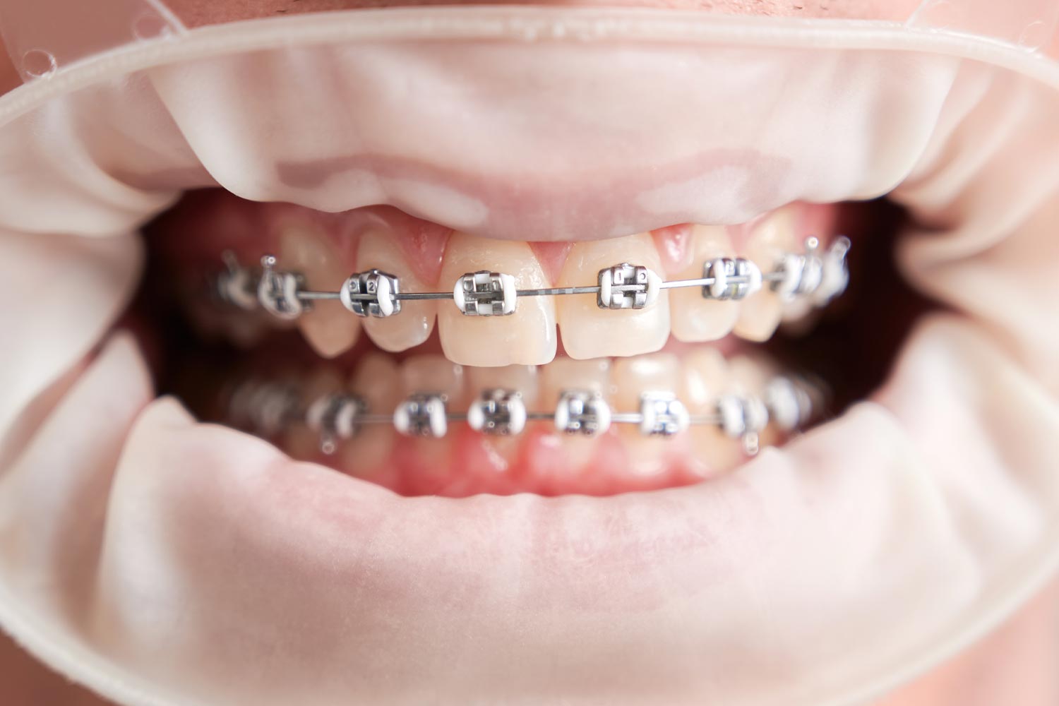 orthodontics orthodontics