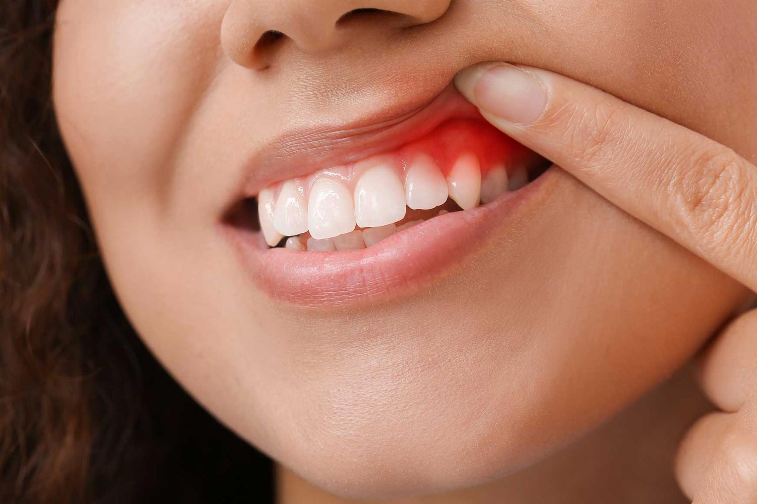 periodontics periodontics