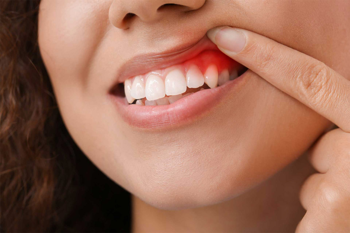 periodontics periodontics